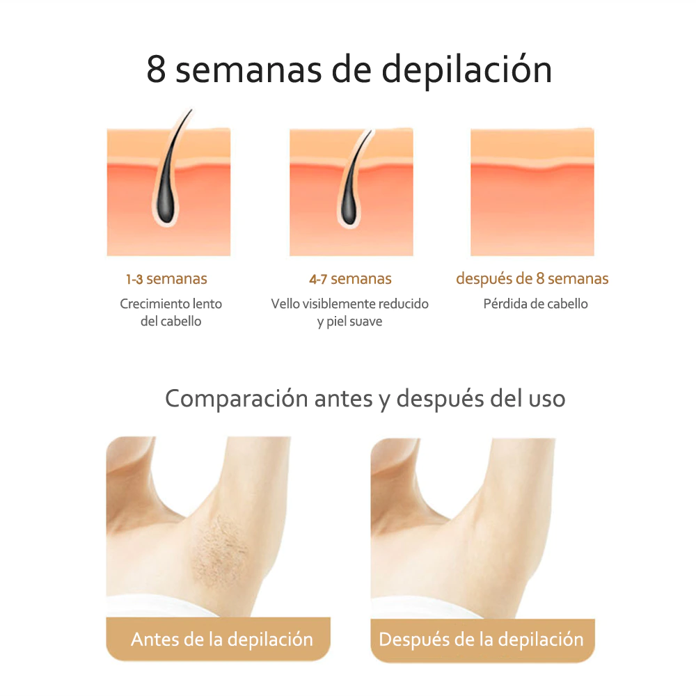 Depiladora IPL Luz Pulsada Recargable Portátil 5 Niveles 500000 Pulsos