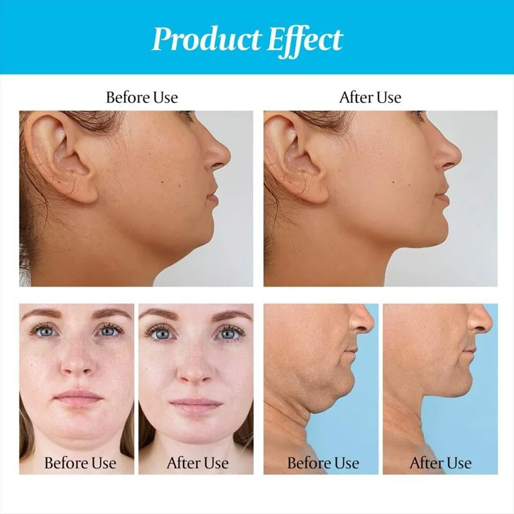 Ejercitador Mandíbula Tonificador Facial Muscular Cuello Rostro Papada
